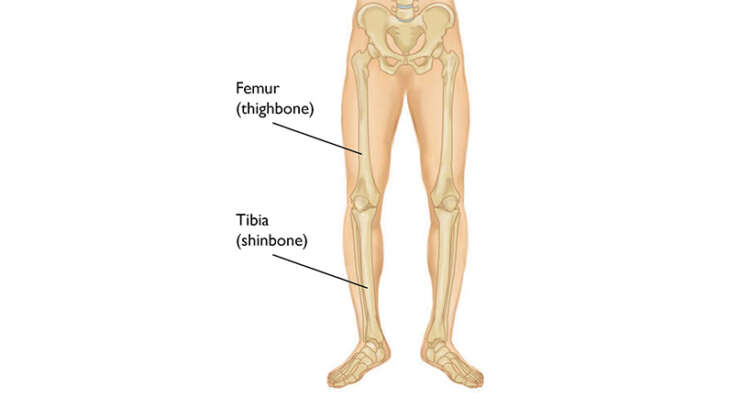 Lower Limb Fractures