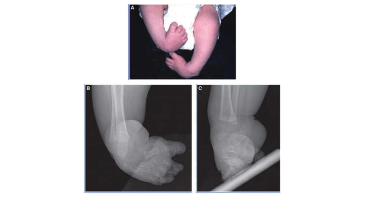 Pediatric Deformity Correction