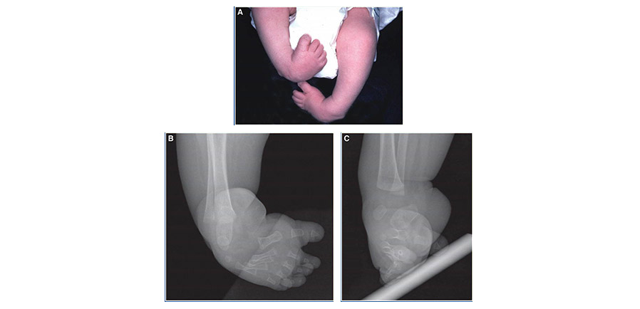 Pediatric Deformity Correction