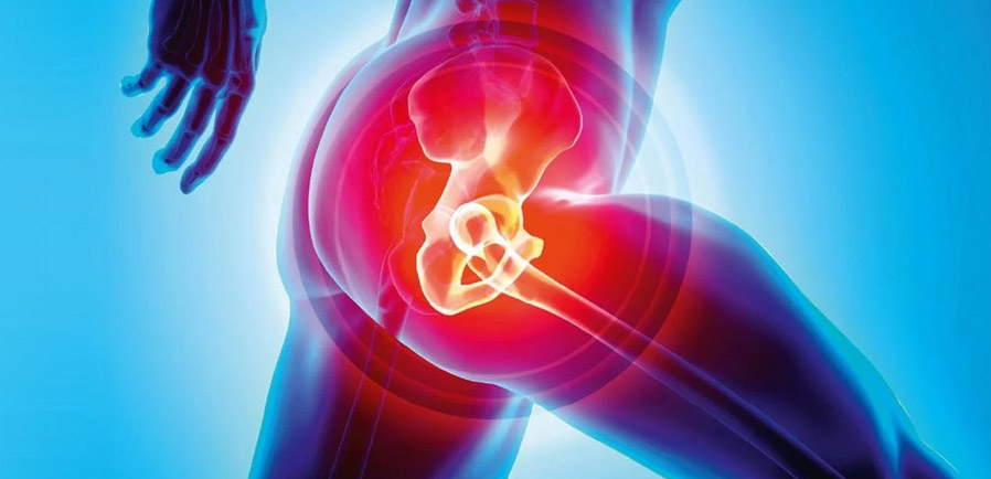 Hip Replacement Surgery